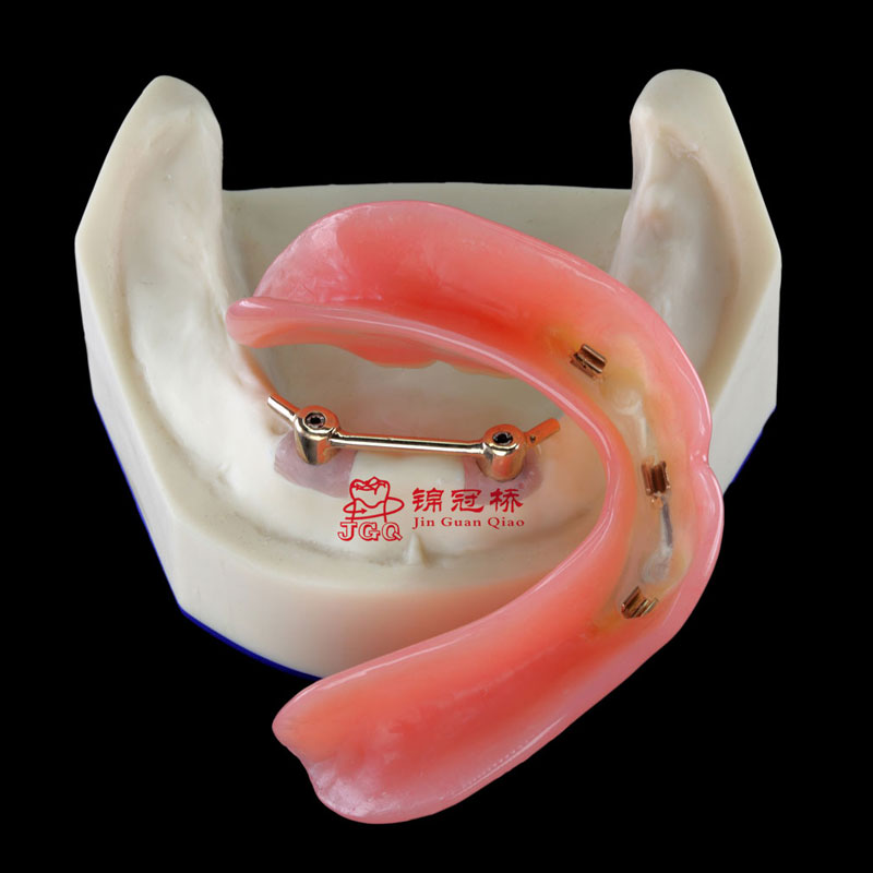 Denture_0235